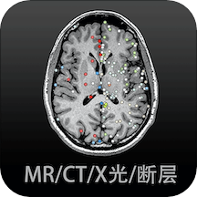 影像解剖图谱免费下载客户端