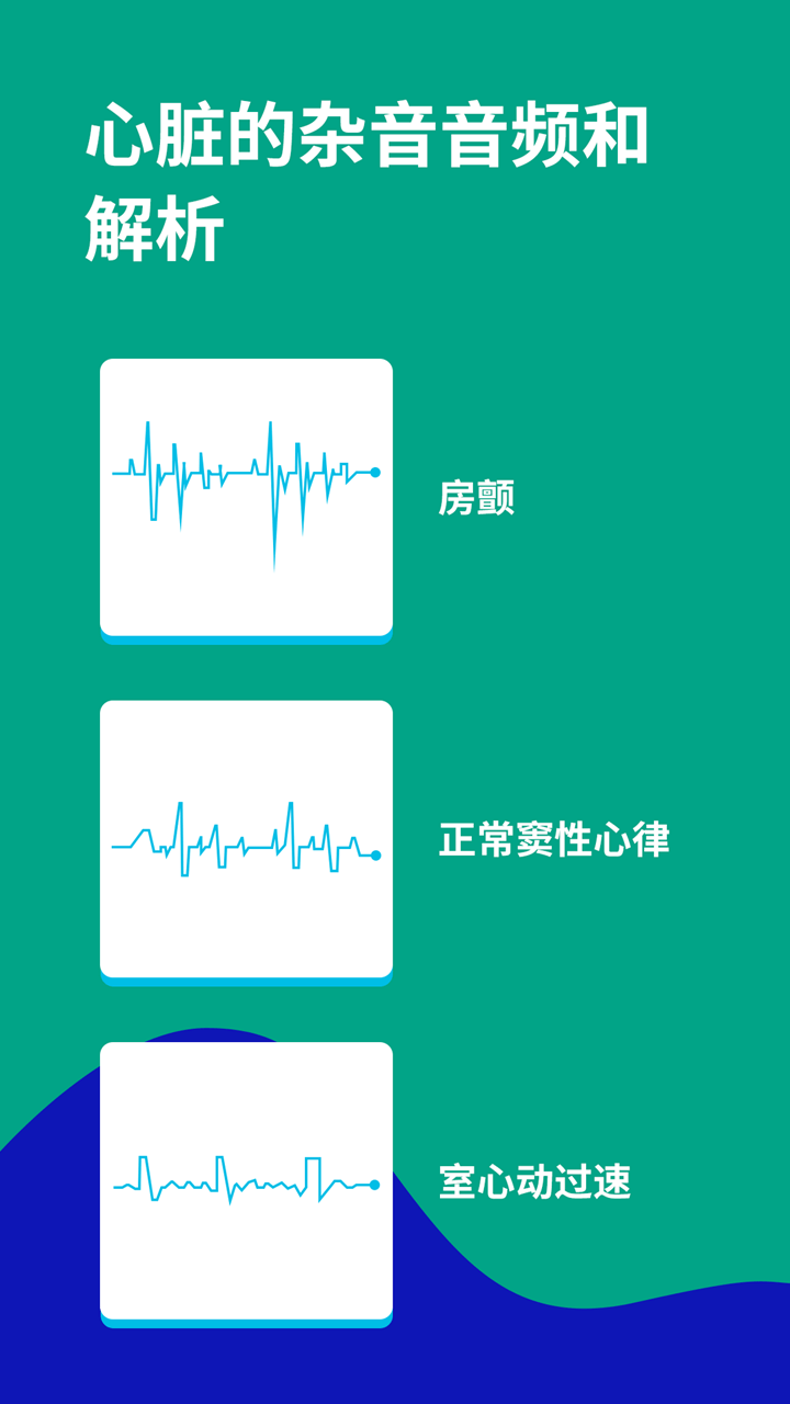 心电图ECG