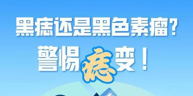 黑色素瘤和普通痣怎么区别 黑色素瘤和普通痣的区别详解